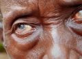 Niger Becomes First African Country to Eliminate River Blindness