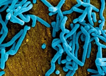 Tanzania Dismisses WHO Report of Suspected Marburg Virus Outbreak