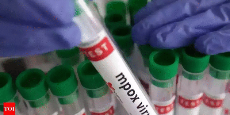 Sierra Leone Accounts for Half of Africa’s Mpox Cases, Fuelling Outbreak