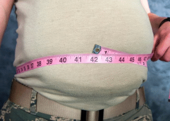 Ghana Health Service Raises Alarm Over Growing Childhood Obesity Rates