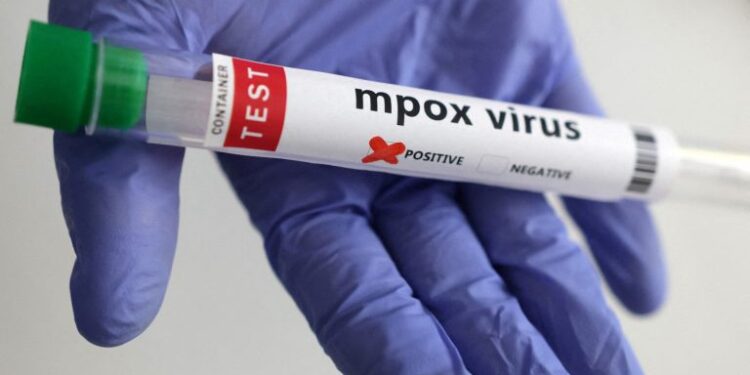 84% of African Mpox Cases in DRC, Sierra Leone, Uganda