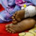 Somalia Grapples with Diphtheria Surge Amid Vaccine Shortages and Aid Cuts