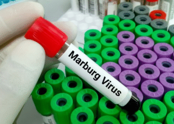 Ethiopia Confirms First Marburg Outbreak as Three People Dead