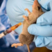 NIGERIA: Benue Declares State of Emergency as Lassa Fever Cases Rise