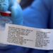 NCDC Debunks Ebola Rumours: No Confirmed Cases in Nigeria